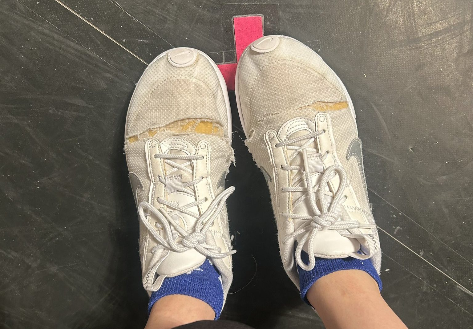 SKE48 伊藤実希さん「アイドルのレッスンシューズ限界突破したらこうなります。」